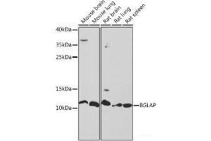 Western blot analysis of extracts of various cell lines using BGLAP Polyclonal Antibody at dilution of 1:1000. (Osteocalcin antibody)