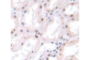Used in DAB staining on fromalin fixed paraffin- embedded Kidney tissue (Spt6 antibody  (AA 532-666))