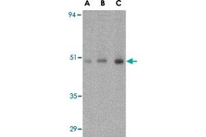 Western blot analysis of ORAI1 in human ovary tissue lysate with ORAI1 polyclonal antibody  at (A) 0.