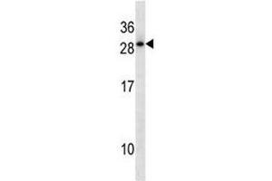 HOXD12 antibody western blot analysis in A549 lysate.