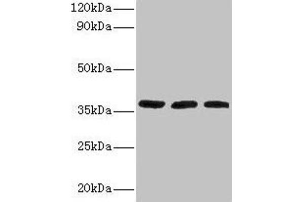 FTSJ1 antibody  (AA 1-329)