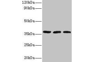 Western blot All lanes: FTSJ1 antibody at 2 μg/mL Lane 1: HepG2 whole cell lysate Lane 2: Mouse brain tissue Lane 3: EC109 whole cell lysate Secondary Goat polyclonal to rabbit IgG at 1/15000 dilution Predicted band size: 37, 36 kDa Observed band size: 37 kDa (FTSJ1 antibody  (AA 1-329))