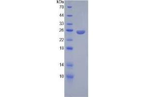 SDS-PAGE of Protein Standard from the Kit  (Highly purified E. (Angiopoietin 2 ELISA Kit)