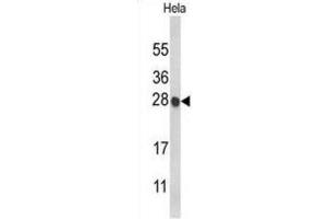 Western Blotting (WB) image for anti-Histone Cluster 1, H1c (HIST1H1C) antibody (ABIN3004061)