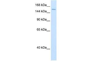 WB Suggested Anti-DHX9 Antibody Titration:  0. (DHX9 antibody  (N-Term))