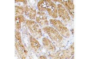 Immunohistochemistry of paraffin-embedded rat kidney using CLNS1A antibody (ABIN7266334) at dilution of 1:100 (40x lens). (CLNS1A antibody  (AA 1-237))