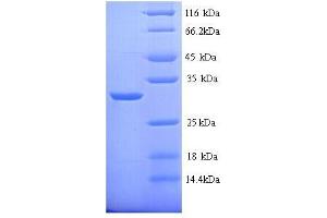 SDS-PAGE (SDS) image for Carbonic Anhydrase I (CA1) (AA 2-261), (full length) protein (His tag) (ABIN7479141)