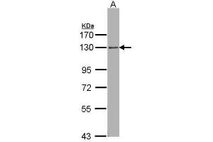 ARHGEF18 anticorps  (Center)