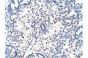 NIP7 antibody was used for immunohistochemistry at a concentration of 4-8 ug/ml to stain Epithelial cells of renal tubule (arrows) in Human Kidney. (NIP7 antibody)