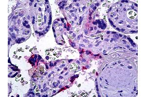 Anti-DOK3 antibody IHC of human placenta. (DOK3 antibody  (AA 484-496))
