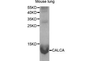 Western Blotting (WB) image for anti-Calcitonin-Related Polypeptide alpha (CALCA) antibody (ABIN1876765) (CGRP antibody)