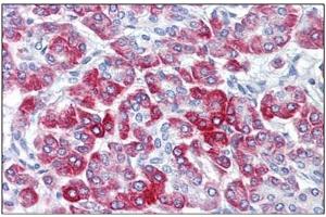 Human Pancreas: Formalin-Fixed, Paraffin-Embedded (FFPE) (RPS6 antibody  (C-Term))
