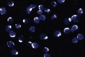 Immunofluorescent staining of Jurkat cells. (BCL2L1 antibody  (AA 18-233))