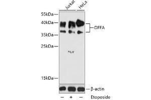 Western blot analysis of extracts of various cell lines, using DFFA antibody (ABIN6127756, ABIN6139549, ABIN6139551 and ABIN6216052) at 1:1000 dilution. (DFFA antibody  (AA 1-331))