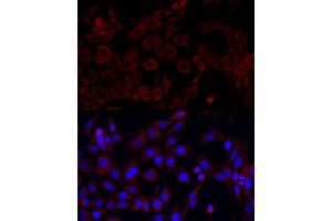 Immunofluorescence analysis of PC-12 cells using PI3 Kinase p85 alpha antibody (ABIN6130617, ABIN6145642, ABIN6145645 and ABIN6215197) at dilution of 1:100.
