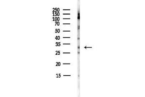 Western blot analysis of lysates from HepG2 cells(starvation,24h treatment), using MMP7 Antibody at 1/1000 dilution.