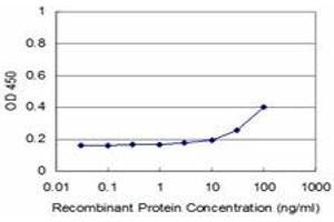 Detection limit for recombinant GST tagged RIPK4 is approximately 3ng/ml as a capture antibody. (RIPK4 antibody  (AA 675-784))