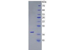 SDS-PAGE analysis of Rat AMH Protein.