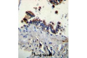 FCN3 Antibody (C-term) immunohistochemistry analysis in formalin fixed and paraffin embedded human lung tissue followed by peroxidase conjugation of the secondary antibody and DAB staining. (FCN3 antibody  (C-Term))