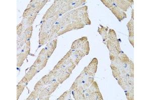 Immunohistochemistry of paraffin-embedded Mouse heart using ATAD3B Polyclonal Antibody at dilution of 1:100 (40x lens). (ATAD3B antibody)