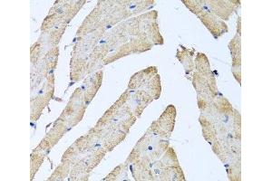 Immunohistochemistry of paraffin-embedded Mouse heart using ATAD3B Polyclonal Antibody at dilution of 1:100 (40x lens).