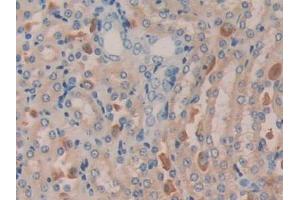 DAB staining on IHC-P; Samples: Mouse Kidney Tissue (MGEA5 antibody  (AA 83-222))