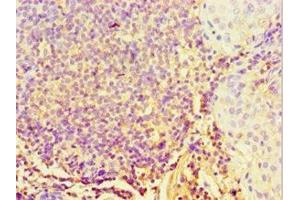 Immunohistochemistry of paraffin-embedded human tonsil tissue using ABIN7170704 at dilution of 1:100 (STARD3 antibody  (AA 170-445))