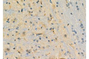 ABIN6261285 and ABIN6276758 at 1/100 staining Rat brain tissue by IHC-P. (Dihydrofolate Reductase antibody  (N-Term))