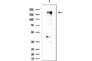 anti-BTB and CNC Homology 1, Basic Leucine Zipper Transcription Factor 2 (BACH2) (Internal Region) antibody
