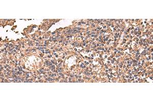 Immunohistochemistry of paraffin-embedded Human tonsil tissue using LDHAL6B Polyclonal Antibody at dilution of 1:65(x200) (LDHAL6B antibody)