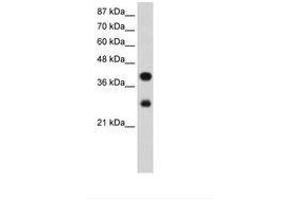 Image no. 2 for anti-Poly(rC) Binding Protein 2 (PCBP2) (AA 191-240) antibody (ABIN203085) (PCBP2 antibody  (AA 191-240))