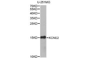 Western blot analysis of extracts of U-251MG cells, using KCNE2 antibody (ABIN6003591) at 1/1000 dilution. (KCNE2 antibody)