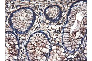 Immunohistochemical staining of paraffin-embedded Human colon tissue using anti-TUBAL3 mouse monoclonal antibody.