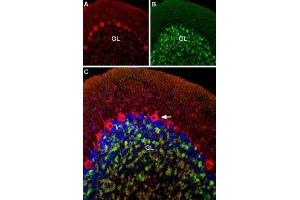 Multiplex staining of CaV1. (CACNA1C antibody  (Intracellular))