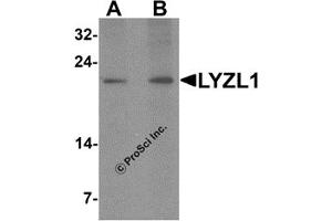 Western Blotting (WB) image for anti-Lysozyme-Like 1 (LYZL1) (N-Term) antibody (ABIN1587946) (Lysozyme-Like 1 antibody  (N-Term))