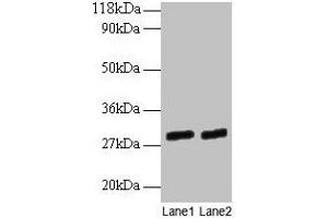 Western blot All lanes: GATD3A antibody at 2 μg/mL Lane 1: EC109 whole cell lysate Lane 2: 293T whole cell lysate Secondary Goat polyclonal to rabbit IgG at 1/15000 dilution Predicted band size: 29, 25 kDa Observed band size: 29 kDa (GATD3A (AA 43-268) antibody)