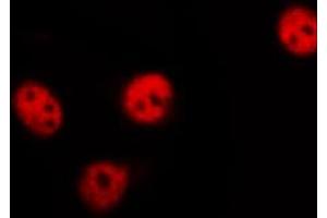 ABIN6267528 staining 293 by IF/ICC. (SAPK, JNK (pThr183) antibody)