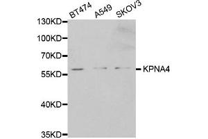 Western Blotting (WB) image for anti-Karyopherin (Importin) alpha 4 (KPNA4) antibody (ABIN1873459)