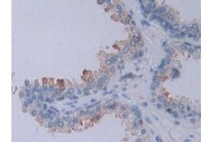 Detection of NRP2 in Human Prostate Tissue using Polyclonal Antibody to Neuropilin 2 (NRP2) (NRP2 antibody  (AA 231-490))