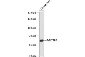 Western blot analysis of extracts of Mouse liver, using PGLYRP2 antibody (ABIN7269206) at 1:1000 dilution. (PGLYRP2 antibody)
