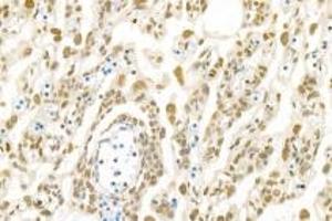 Immunohistochemistry analysis of paraffin-embedded rat placenta using,PNN (ABIN7075083) at dilution of 1: 1200 (PNN antibody)