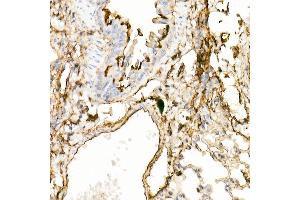 Immunohistochemistry of paraffin-embedded mouse lung using Annexin  Rabbit pAb  at dilution of 1:25 (40x lens). (Annexin A2 antibody)