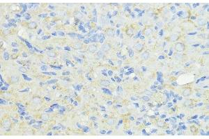 Immunohistochemistry of paraffin-embedded Rat ovary using CTSB Polyclonal Antibody at dilution of 1:100 (40x lens). (Cathepsin B antibody)