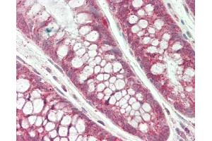 Human Colon: Formalin-Fixed, Paraffin-Embedded (FFPE). (DDIT3 antibody  (AA 1-169) (Biotin))