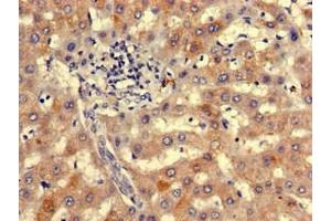Immunohistochemistry of paraffin-embedded human liver tissue using ABIN7161618 at dilution of 1:100 (NIPBL antibody  (AA 2523-2697))