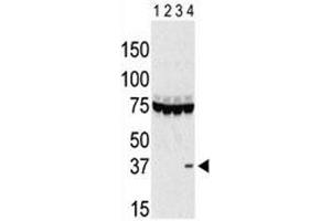 Western blot testing of Aurora-C antibody and lysate of 293 cells expressing 1) Flag tag, 2) Flag-tagged -A, 3) -B and 4) Aurora-C. (Aurora Kinase C antibody  (AA 115-145))