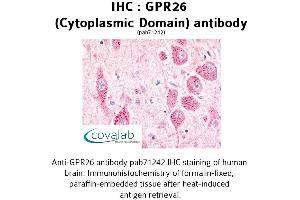 Image no. 1 for anti-G Protein-Coupled Receptor 26 (GPR26) (3rd Cytoplasmic Domain) antibody (ABIN1735037) (GPR26 antibody  (3rd Cytoplasmic Domain))