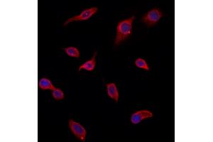 ABIN6266223 and ABIN6277374 staining HepG2 by IF/ICC.