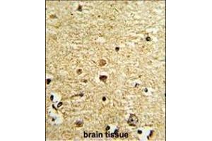 Formalin-fixed and paraffin-embedded human brain tissue with OLIG3 Antibody (Center), which was peroxidase-conjugated to the secondary antibody, followed by DAB staining. (OLIG3 antibody  (AA 74-100))