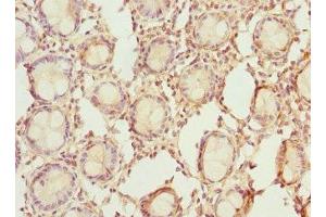 Immunohistochemistry of paraffin-embedded human colon tissue using ABIN7142076 at dilution of 1:100 (RDH5 antibody  (AA 24-318))